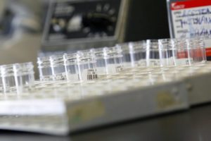 Read more about the article OMS retoma ensaios clínicos com hidroxicloroquina