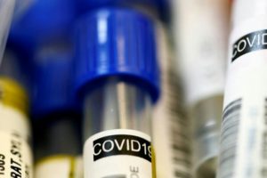 Read more about the article Mais um caso positivo na cidade da Praia eleva para 68 em Cabo Verde