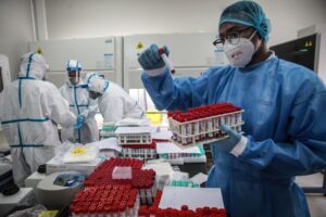 Read more about the article Angola contabiliza mais 37 infeções e dois mortos em 24 horas