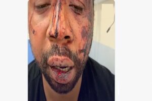 Read more about the article Macron “consternado” com espancamento brutal de negro pela polícia em França