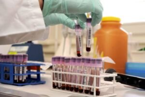 Read more about the article Análise de sangue pode vir a detetar cancro em pessoas ainda sem sintomas