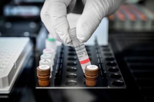 Read more about the article Autoridades de Saúde nos EUA diminuem para cinco dias isolamento de infetados