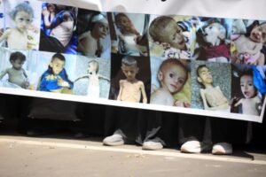 Read more about the article OMS diz que grande parte da população de Gaza morre de fome